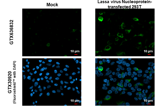 Lassa virus Nucleoprotein antibody [HL1392]